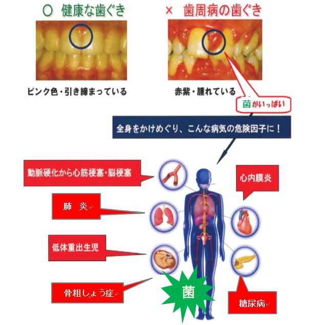 健口コラムR2年3月画像1