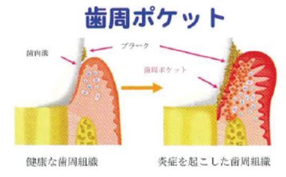 健口コラムR2年5月画像2