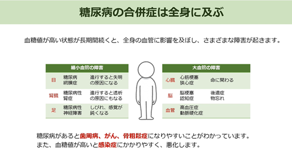 【令和７年度～】まめコラム_MAMEインフォ（糖尿病の管理）
