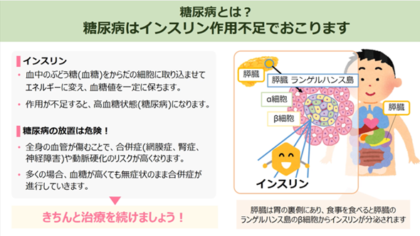 【令和７年度～】まめコラム_MAMEインフォ（糖尿病の発症とその予防）