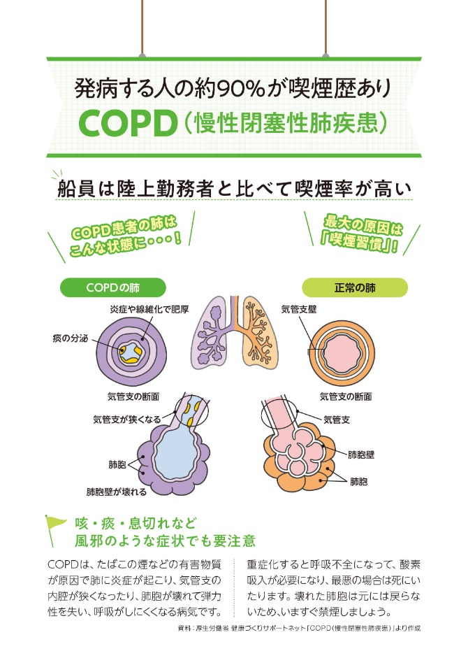 発病する人の約90％が喫煙歴あり COPD（慢性閉塞性肺疾患）