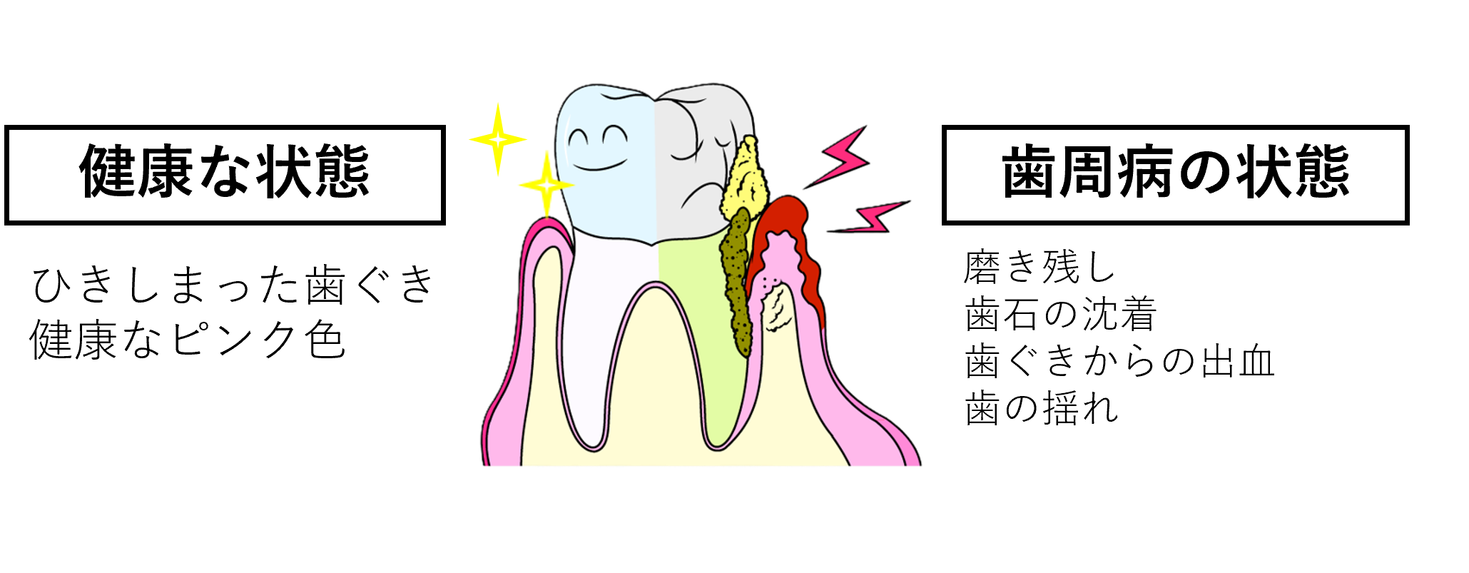 sikakoramu2-2
