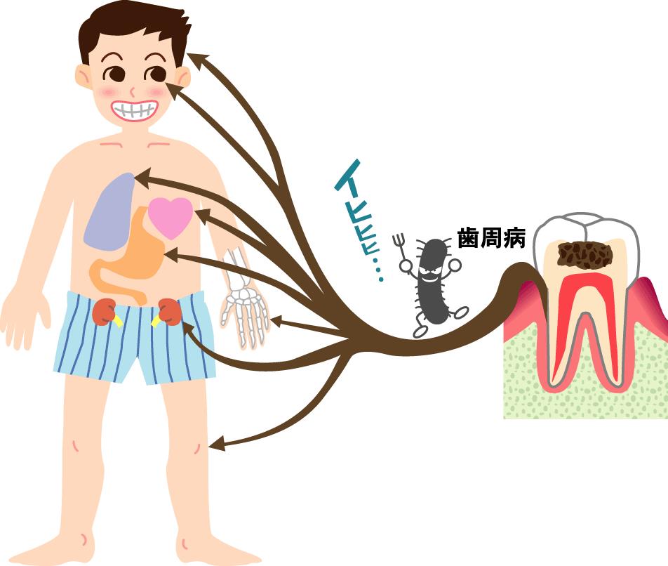 歯 周 病 赤ちゃん に 影響