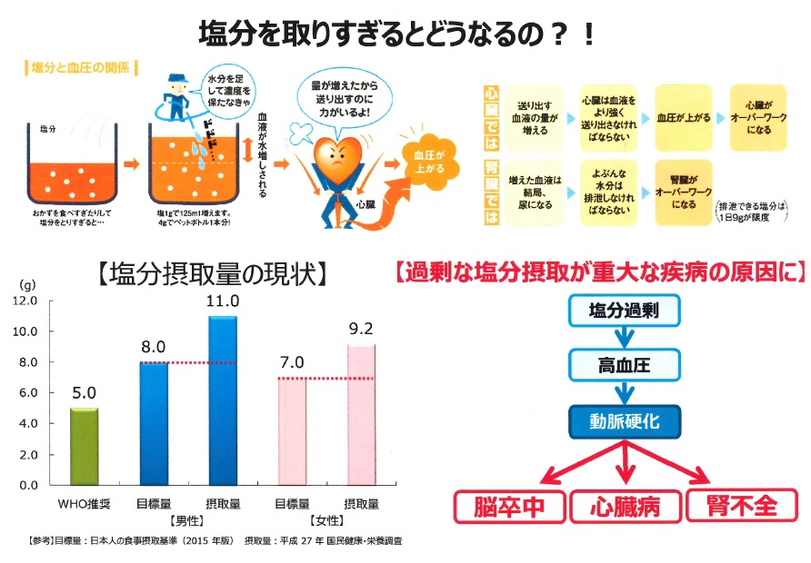 塩分の摂りすぎになっていませんか 減塩対策 都道府県支部 全国健康保険協会