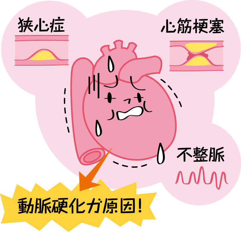 心疾患