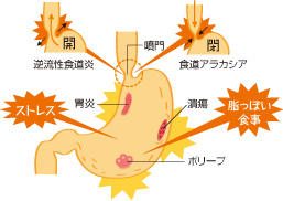 胃・食道の病気