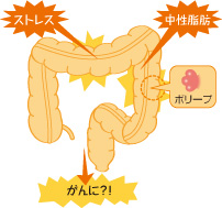 大腸の病気